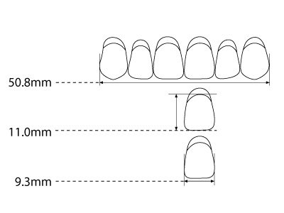 Anterior Upper T10 B4 - Standard Image - 2