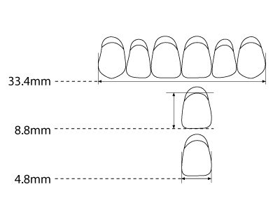 Kaili Anterior Lower L6 A3.5 - Standard Image - 2