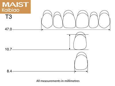 Maist Anterior Upper T3 A2 - Standard Image - 2